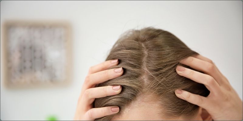 Caduta dei capelli
